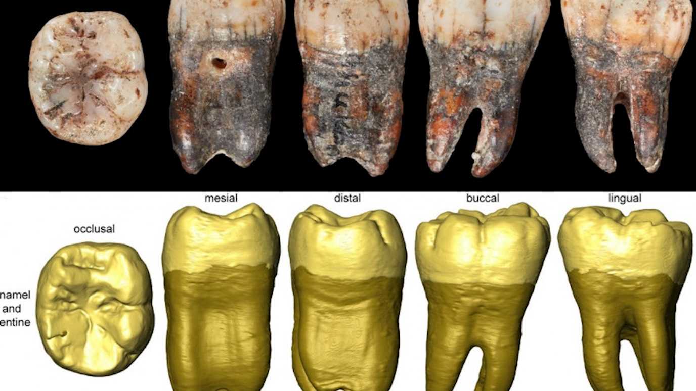 Neanderthal childs tooth Courtesy of the Natural History Museum, London