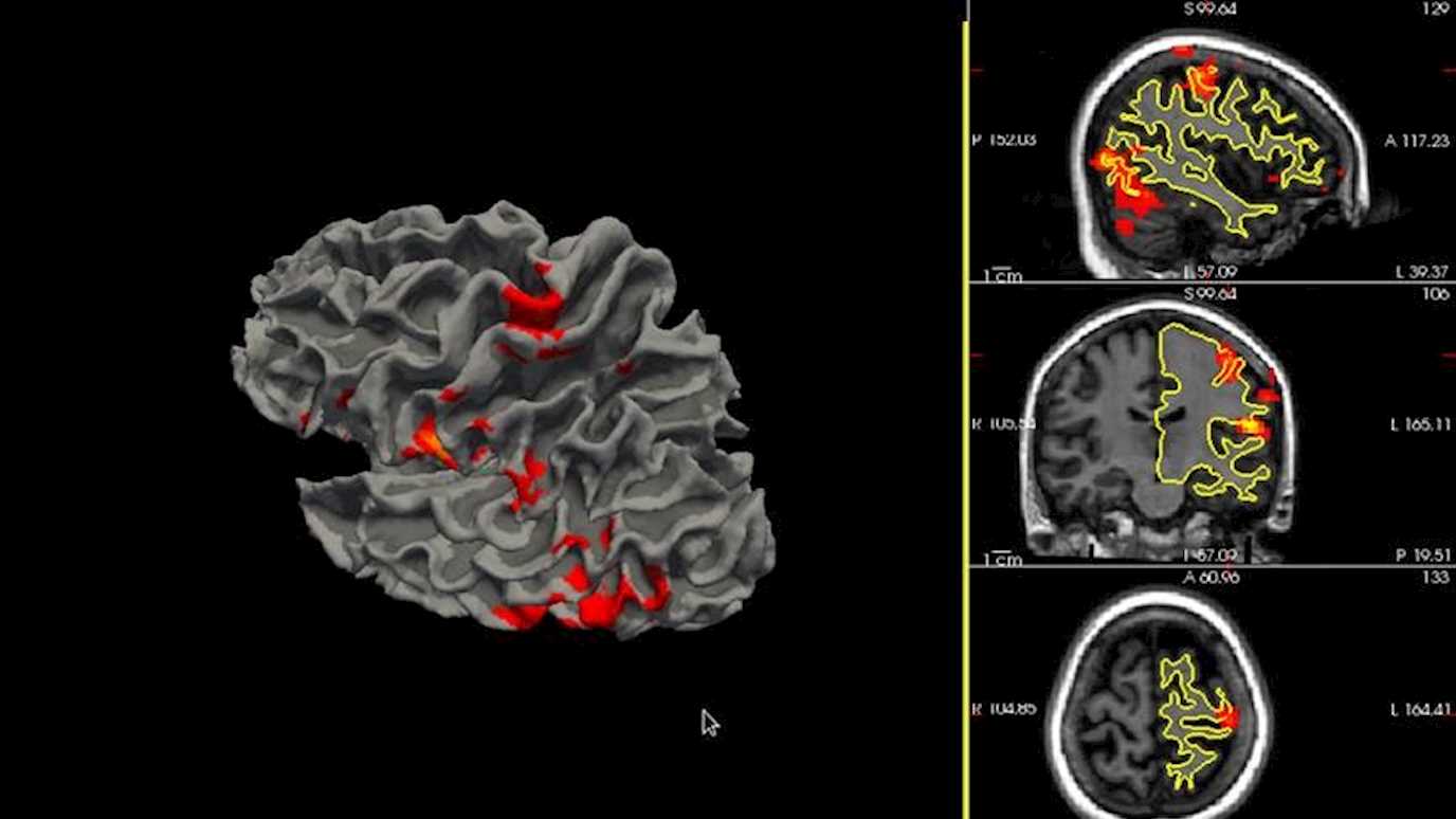 Human brain mapping 2 - Psychology News