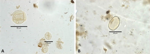 Image of Pollen grains